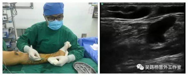 1642574721742998.png image.png