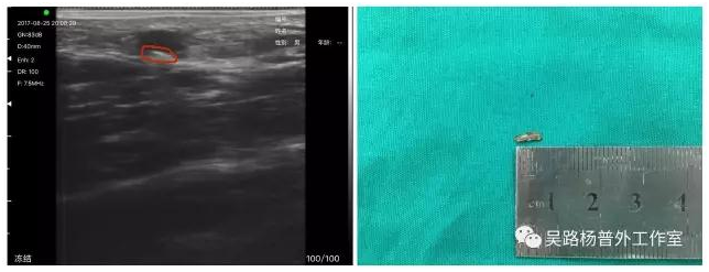 1642574709172542.png image.png