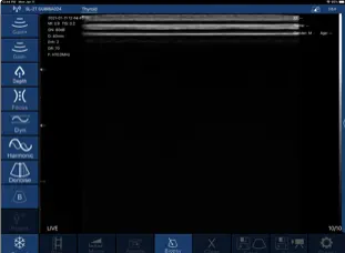 探头式掌上超声安卓版本APP