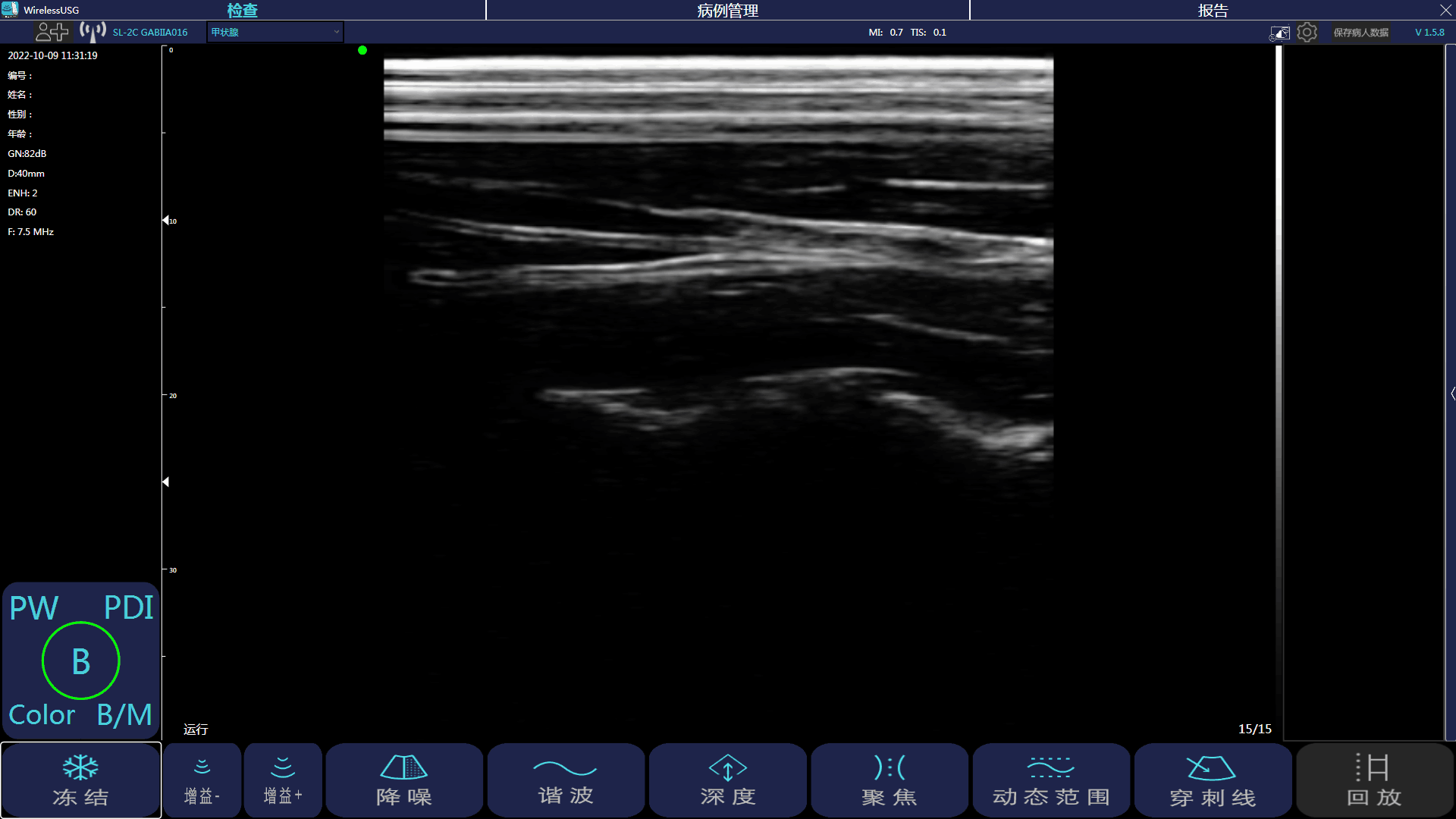 探头式掌上超声Windows版本APP