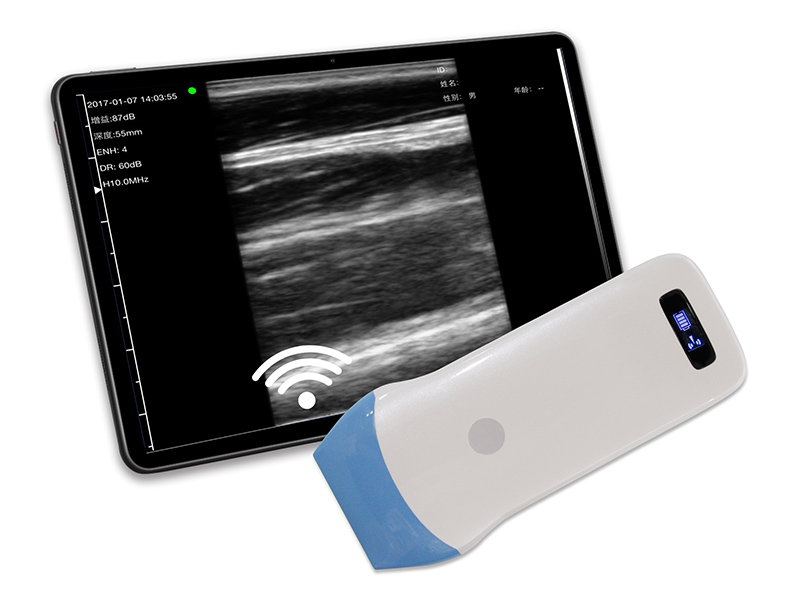 5L标配线阵无线探头式掌上黑白超