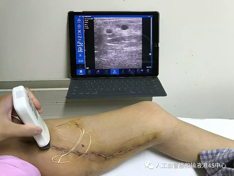 2023032210930837.jpg mmexport1501917799611.jpg