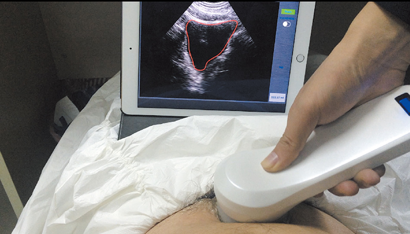 2023032219539689.jpg 4D膀胱仪-35x20cm-拷贝.jpg