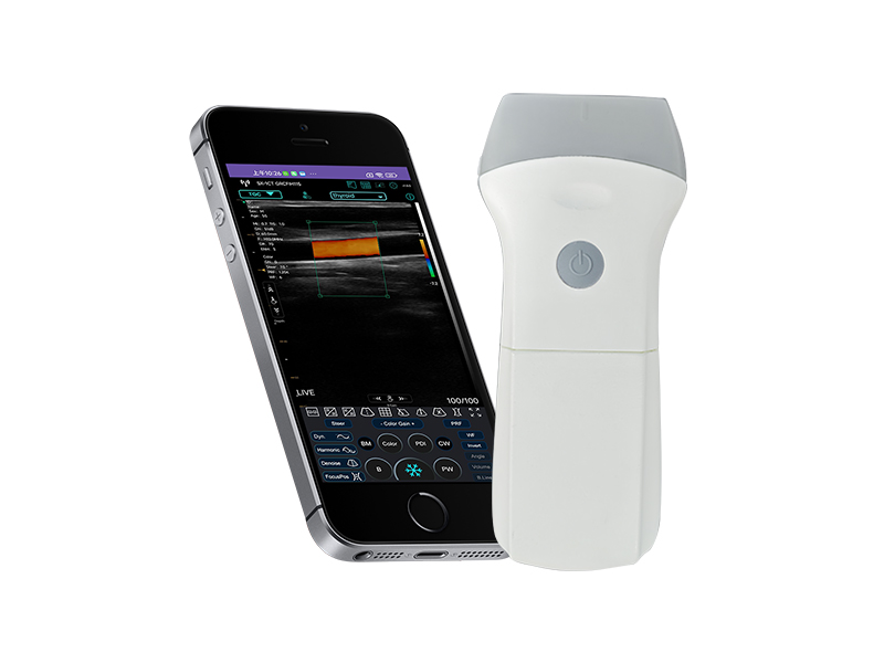 9L 可换电池线阵无线探头式掌上彩超