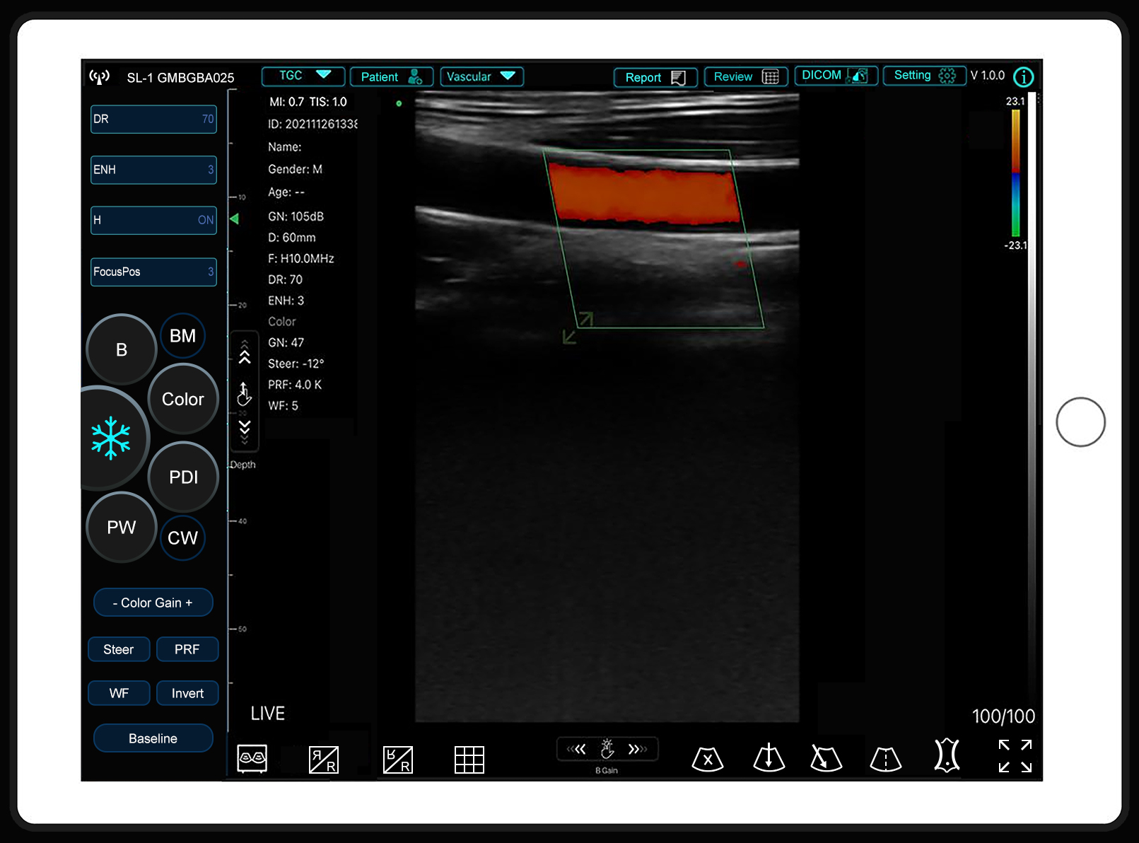 Sonostar has released a new APP called SmartUSG