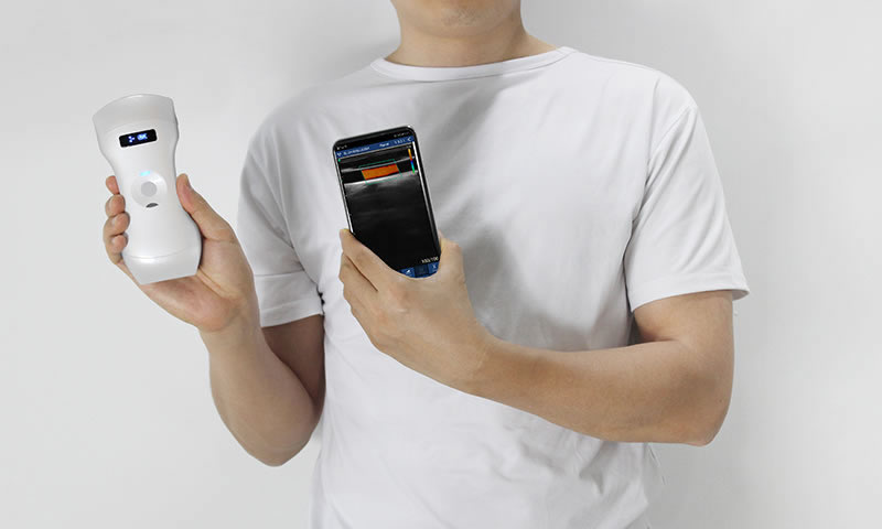 Can Wireless Probe‑Based Handheld Ultrasound Meet the Needs of Routine Community‑Based Preliminary Screening