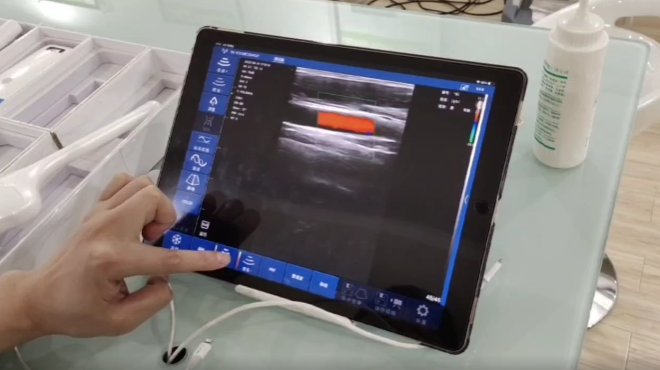 Pocket Handheld Ultrasound